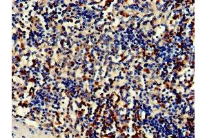 Immunohistochemistry of paraffin-embedded human spleen tissue using ABIN7149082 at dilution of 1:100 (CDA 抗体  (AA 1-146))