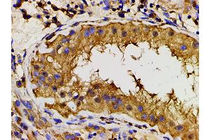 Immunohistochemistry (IHC) image for anti-Phosphoinositide 3 Kinase, p85 alpha (PI3K p85a) (pTyr607) antibody (ABIN6256775)