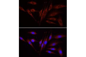 Immunofluorescence analysis of NIH/3T3 cells using WNT1 antibody (ABIN1683291, ABIN3016105, ABIN3016107 and ABIN6219551) at dilution of 1:100.