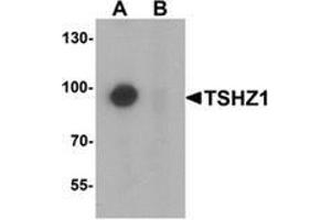 Western blot analysis of TSHZ1 in A-20 cell lysate with TSHZ1 Antibody  at 1 µg/ml in (A) the absence and (B) the presence of blocking peptide. (TSHZ1 抗体  (N-Term))