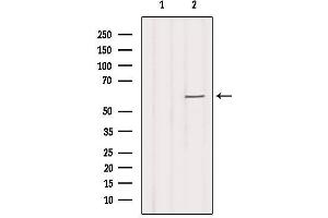 Western blot analysis of extracts from Hela, using SLC16A2 Antibody. (SLC16A2/MCT8 抗体  (Internal Region))