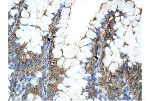 Image no. 1 for anti-Peptidylprolyl Isomerase A (Cyclophilin A) (PPIA) (C-Term) antibody (ABIN321858) (PPIA 抗体  (C-Term))