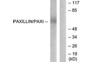 Western blot analysis of extracts from HeLa cells, using Paxillin (Ab-118) Antibody. (Paxillin 抗体  (AA 85-134))