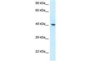 Image no. 1 for anti-RNA Binding Motif Protein, X-Linked (RBMX) (AA 314-363) antibody (ABIN6747638) (RBMX 抗体  (AA 314-363))
