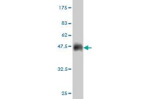 Western Blot detection against Immunogen (36. (IGDCC4 抗体  (AA 1152-1250))