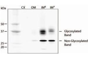 Western blot analysis of Aqp2 in rat kidney extracts using Aqp2 polyclonal antibody . (AQP2 抗体  (AA 200-300))