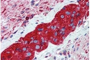 Human Small Intestine, Myenteric Plexus: Formalin-Fixed, Paraffin-Embedded (FFPE) (TUBB2A 抗体  (AA 1-446))