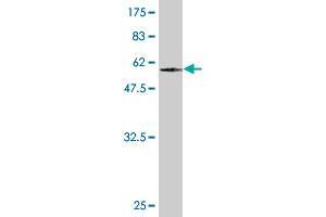 Western Blot detection against Immunogen (59. (TADA2L 抗体  (AA 1-305))