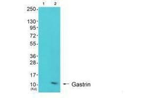 Western blot analysis of extracts from K562 cells (Lane 2), using Gastrin antiobdy.
