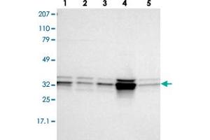 Western blot analysis of lane 1: RT-4, lane 2: EFO-21, lane 3: A-431, lane 4: Liver and lane 5: Tonsil using MPST polyclonal antibody . (MPST 抗体)