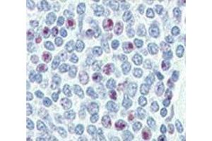 Immunohistochemistry (IHC) image for anti-Nanog Homeobox (NANOG) (AA 15-49) antibody (ABIN3031942)