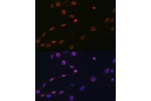 Immunofluorescence analysis of NIH-3T3 cells using K/H Rabbit mAb (ABIN7267702) at dilution of 1:100 (40x lens). (HAT1 抗体)