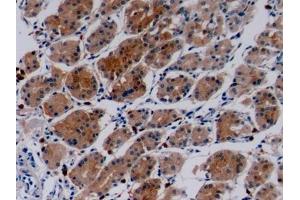 Immunohistochemistry (IHC) image for anti-Collagen, Type IV, alpha 3 (COL4A3) (AA 1428-1670) antibody (ABIN7434707)