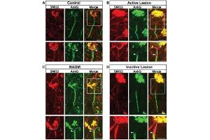 Representative cortical layer 5/6 pyramidal neurons from control, (B) active MS lesion, (C) NAGM, (D) inactive MS lesion tissues immunolabelled with anti-SMI32, and their AIS immunolabelled with anti-AnkG.