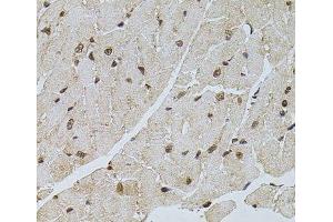 Immunohistochemistry of paraffin-embedded Mouse heart using PPP2R5C Polyclonal Antibody at dilution of 1:100 (40x lens). (PPP2R5C 抗体)