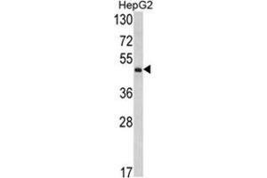 Western blot analysis of OTC Antibody (Center) in HepG2 cell line lysates (35ug/lane). (OTC 抗体  (Middle Region))