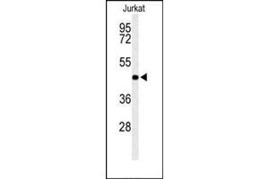 Western blot analysis in Jurkat cell line lysates (35 ug/lane) using RPR1B Antibody (C-term) Cat.