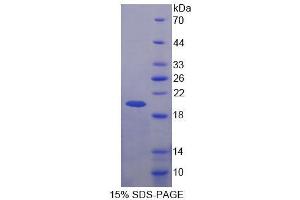 SDS-PAGE analysis of Human BRCC3 Protein. (BRCC3 蛋白)