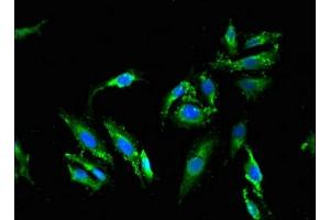 Immunofluorescent analysis of Hela cells using ABIN7159304 at dilution of 1:100 and Alexa Fluor 488-congugated AffiniPure Goat Anti-Rabbit IgG(H+L) (Melanophilin 抗体  (AA 310-539))