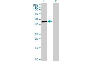 Western Blot analysis of UGT3A1 expression in transfected 293T cell line by UGT3A1 MaxPab polyclonal antibody. (UGT3A1 抗体  (AA 1-523))