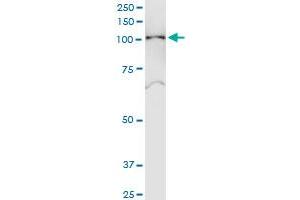 Immunoprecipitation of SNX19 transfected lysate using anti-SNX19 MaxPab rabbit polyclonal antibody and Protein A Magnetic Bead , and immunoblotted with SNX19 purified MaxPab mouse polyclonal antibody (B01P) . (SNX19 抗体  (AA 1-803))