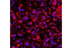 Immunofluorescence of paraffin embedded mouse placenta using Neil1 (ABIN7073820) at dilution of 1: 300 (400x lens)