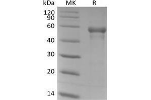 Western Blotting (WB) image for beta-1,3-Glucuronyltransferase 1 (Glucuronosyltransferase P) (B3GAT1) protein (His tag) (ABIN7319929) (CD57 Protein (His tag))