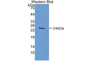 Western blot analysis of the recombinant protein.
