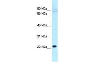 Image no. 1 for anti-C-Type Lectin Domain Family 5, Member A (CLEC5A) (AA 110-159) antibody (ABIN6747837) (CLEC5A 抗体  (AA 110-159))