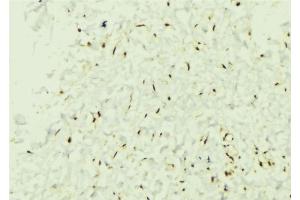 ABIN6274379 at 1/100 staining Mouse muscle tissue by IHC-P. (MAPKAP Kinase 3 抗体  (C-Term))