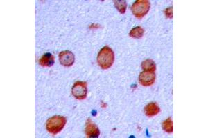 Immunohistochemistry (IHC) image for anti-Glutamate Receptor, Ionotropic, AMPA 2 (GRIA2) (C-Term), (pSer880) antibody (ABIN7300766)