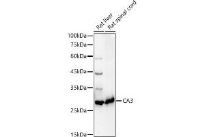 Western blot analysis of extracts of various cell lines, using C antibody (ABIN6131265, ABIN6137793, ABIN6137794 and ABIN6217485) at 1:1000 dilution. (CA3 抗体  (AA 1-260))