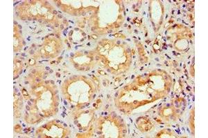 Immunohistochemistry of paraffin-embedded human kidney tissue using ABIN7169428 at dilution of 1:100 (ASH2L 抗体  (AA 329-628))