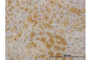 Immunoperoxidase of monoclonal antibody to TTC1 on formalin-fixed paraffin-embedded human liver. (TTC1 抗体  (AA 193-292))