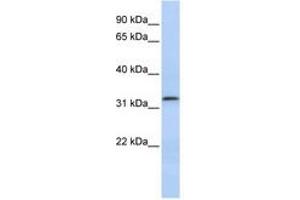 Image no. 1 for anti-Lactamase, beta 2 (LACTB2) (AA 107-156) antibody (ABIN6741397) (LACTB2 抗体  (AA 107-156))