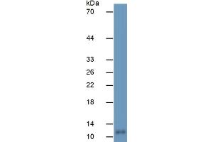 Mouse Capture antibody from the kit in WB with Positive Control:  Human Brain Tissue. (S100B ELISA 试剂盒)