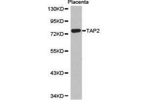 Western Blotting (WB) image for anti-Transporter 2, ATP-Binding Cassette, Sub-Family B (MDR/TAP) (TAP2) antibody (ABIN1875021) (TAP2 抗体)