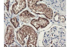 Immunohistochemical staining of paraffin-embedded Human Kidney tissue using anti-PDSS2 mouse monoclonal antibody. (PDSS2 抗体)