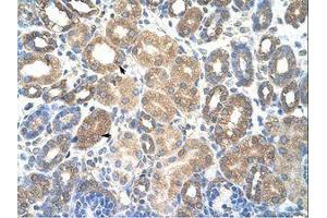 Image no. 1 for anti-HSPB (Heat Shock 27kDa) Associated Protein 1 (HSPBAP1) (AA 412-461) antibody (ABIN6736308) (HSPBAP1 抗体  (AA 412-461))