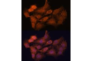 Immunofluorescence analysis of C6 cells using SYCP2 antibody (ABIN7270668) at dilution of 1:100. (SYCP2 抗体  (AA 1231-1530))