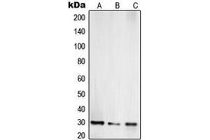 Western blot analysis of TOLLIP expression in Jurkat (A), LNCaP (B), HepG2 (C) whole cell lysates. (TOLLIP 抗体  (Center))