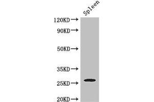 Western Blot Positive WB detected in: Mouse spleen tissue All lanes: ZC4H2 antibody at 3 μg/mL Secondary Goat polyclonal to rabbit IgG at 1/50000 dilution Predicted band size: 27, 16, 24, 21, 26 kDa Observed band size: 27 kDa (ZC4H2 抗体  (AA 1-224))