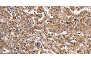 Immunohistochemistry (Paraffin-embedded Sections) (IHC (p)) image for anti-Potassium Voltage-Gated Channel, Subfamily G, Member 2 (Kcng2) antibody (ABIN7239134)