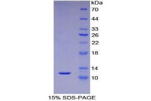 SDS-PAGE analysis of Human S100A5 Protein. (S100A5 蛋白)