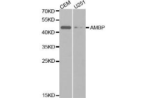 Western blot analysis of extracts of various cell lines, using AMBP antibody (ABIN5970945) at 1/1000 dilution. (AMBP 抗体)