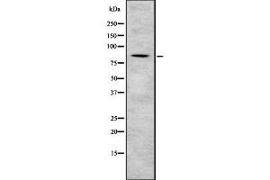 Western blot analysis Sec23B using NIH-3T3 whole cell lysates (Sec23 Homolog B 抗体  (Internal Region))