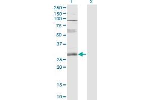 Western Blot analysis of ZNF138 expression in transfected 293T cell line by ZNF138 monoclonal antibody (M01), clone 4D11. (ZNF138 抗体  (AA 151-251))