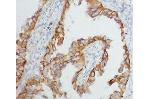 Immunohistochemistry (IHC) image for anti-Tumor Necrosis Factor alpha (TNF alpha) (AA 201-233) antibody (ABIN3029349)