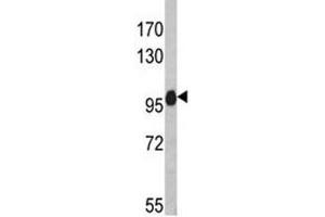Western blot analysis of anti-NLRP12 antibody and HL-60 lysate (NLRP12 抗体)