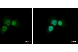 Immunofluorescence (IF) image for anti-Nibrin (NBN) antibody (ABIN2855584)